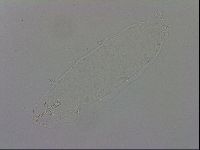 Mesobiotus montanus image