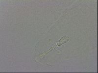 Mesobiotus montanus image