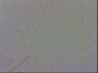 Mesobiotus montanus image