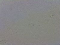 Mesobiotus montanus image