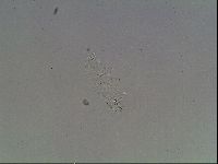 Mesobiotus montanus image