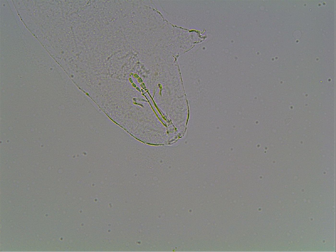 Mesobiotus montanus image