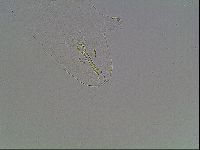Mesobiotus montanus image