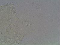 Mesobiotus montanus image