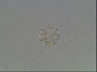 Mesobiotus montanus image