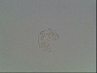 Mesobiotus montanus image
