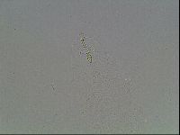Mesobiotus montanus image