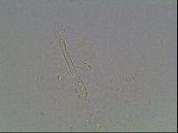 Mesobiotus montanus image