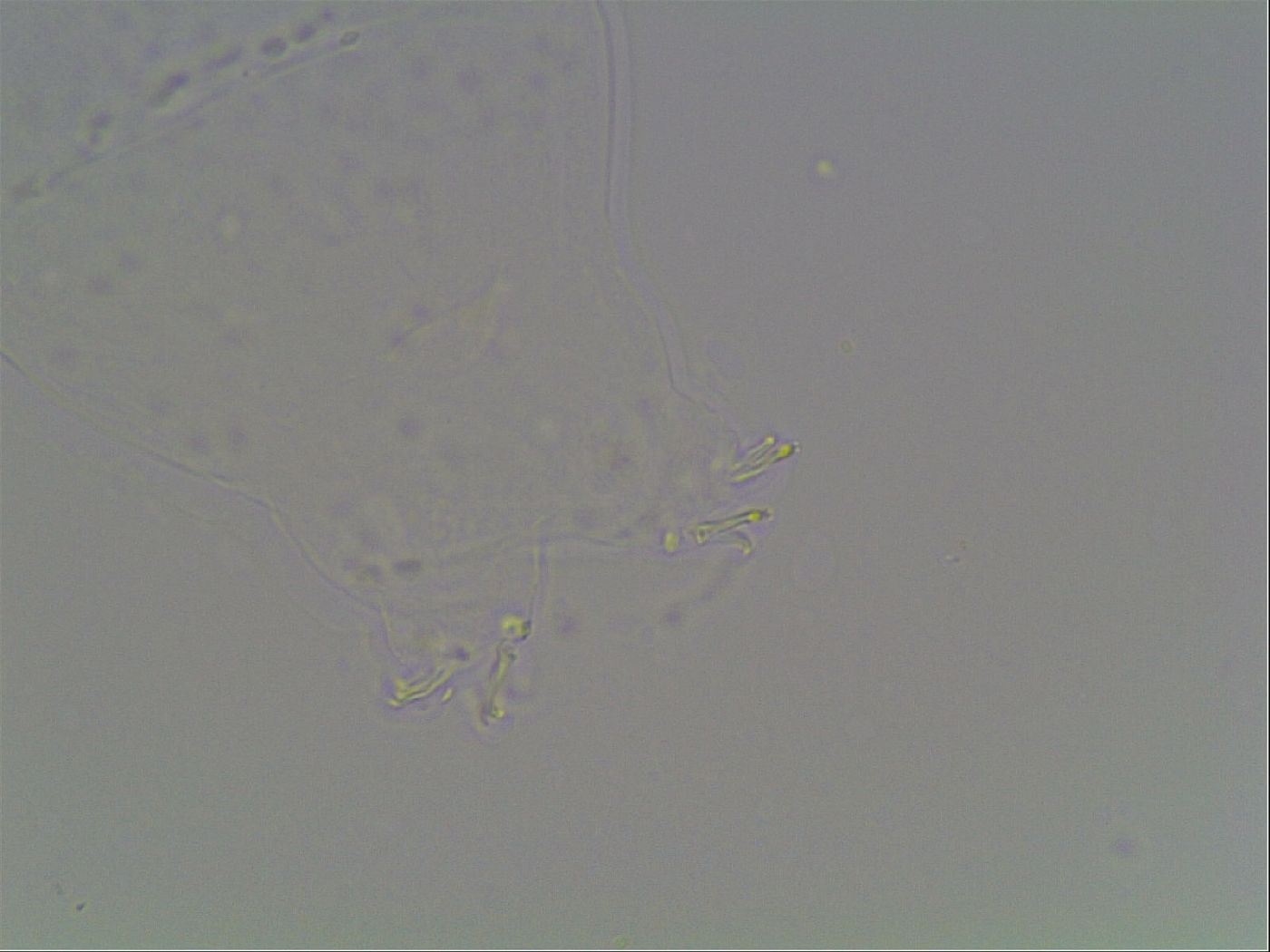 Mesobiotus montanus image