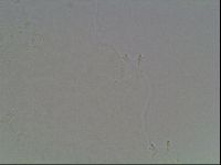 Mesobiotus montanus image