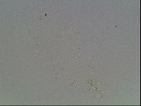 Mesobiotus montanus image