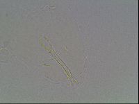 Mesobiotus montanus image