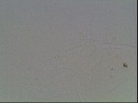 Mesobiotus montanus image