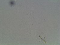 Mesobiotus montanus image