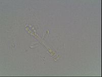Mesobiotus montanus image
