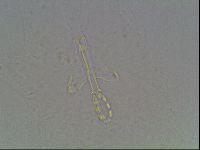 Media resource of Mesobiotus montanus