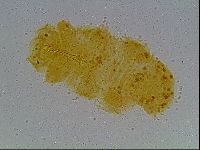 Mesobiotus montanus image