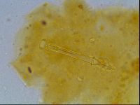 Mesobiotus montanus image