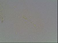 Mesobiotus montanus image