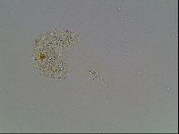 Mesobiotus montanus image