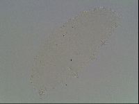 Mesobiotus montanus image