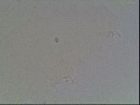 Mesobiotus montanus image