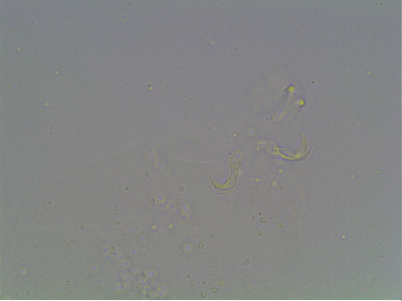 Mesobiotus montanus image