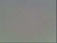 Mesobiotus montanus image