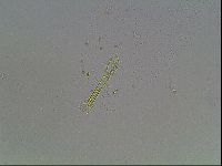 Mesobiotus montanus image