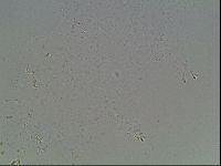 Mesobiotus montanus image