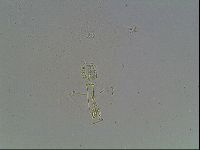 Mesobiotus montanus image