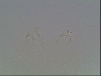 Mesobiotus montanus image