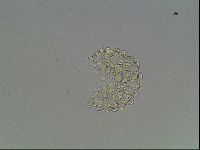 Mesobiotus montanus image