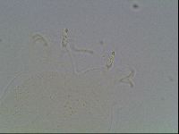 Mesobiotus liviae image