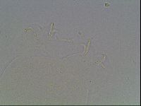 Mesobiotus liviae image
