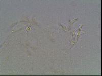 Mesobiotus liviae image