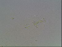 Mesobiotus liviae image