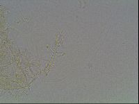 Mesobiotus liviae image