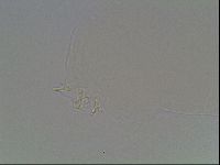 Mesobiotus orcadensis image