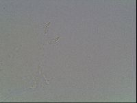 Mesobiotus orcadensis image