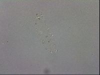 Mesobiotus orcadensis image