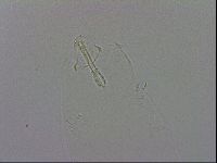 Mesobiotus orcadensis image