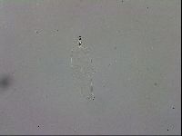 Mesobiotus orcadensis image