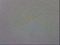 Mesobiotus orcadensis image