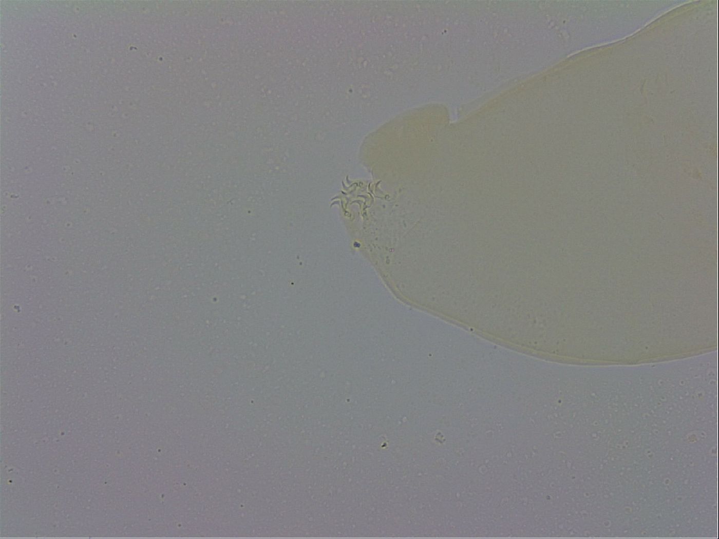 Mesobiotus orcadensis image