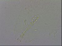 Mesobiotus orcadensis image