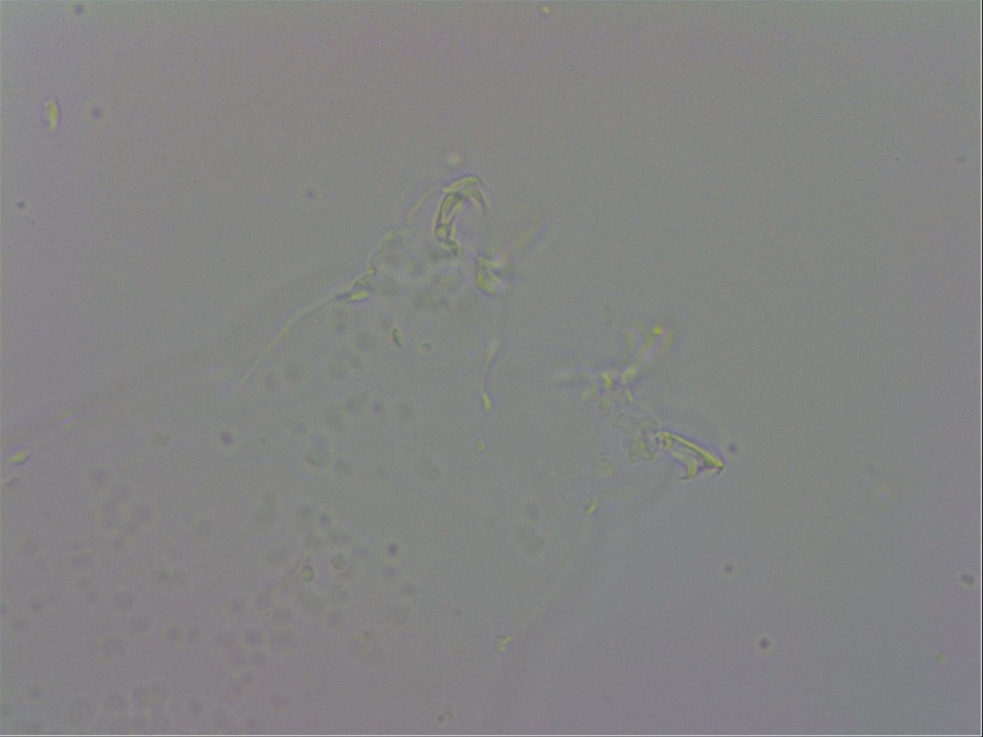 Mesobiotus orcadensis image