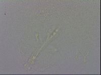 Mesobiotus orcadensis image