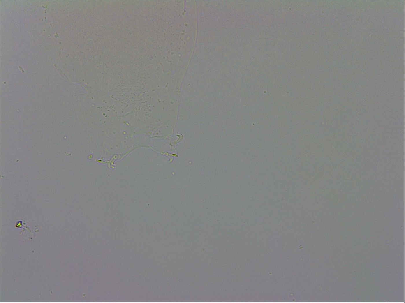 Mesobiotus orcadensis image