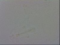Mesobiotus orcadensis image